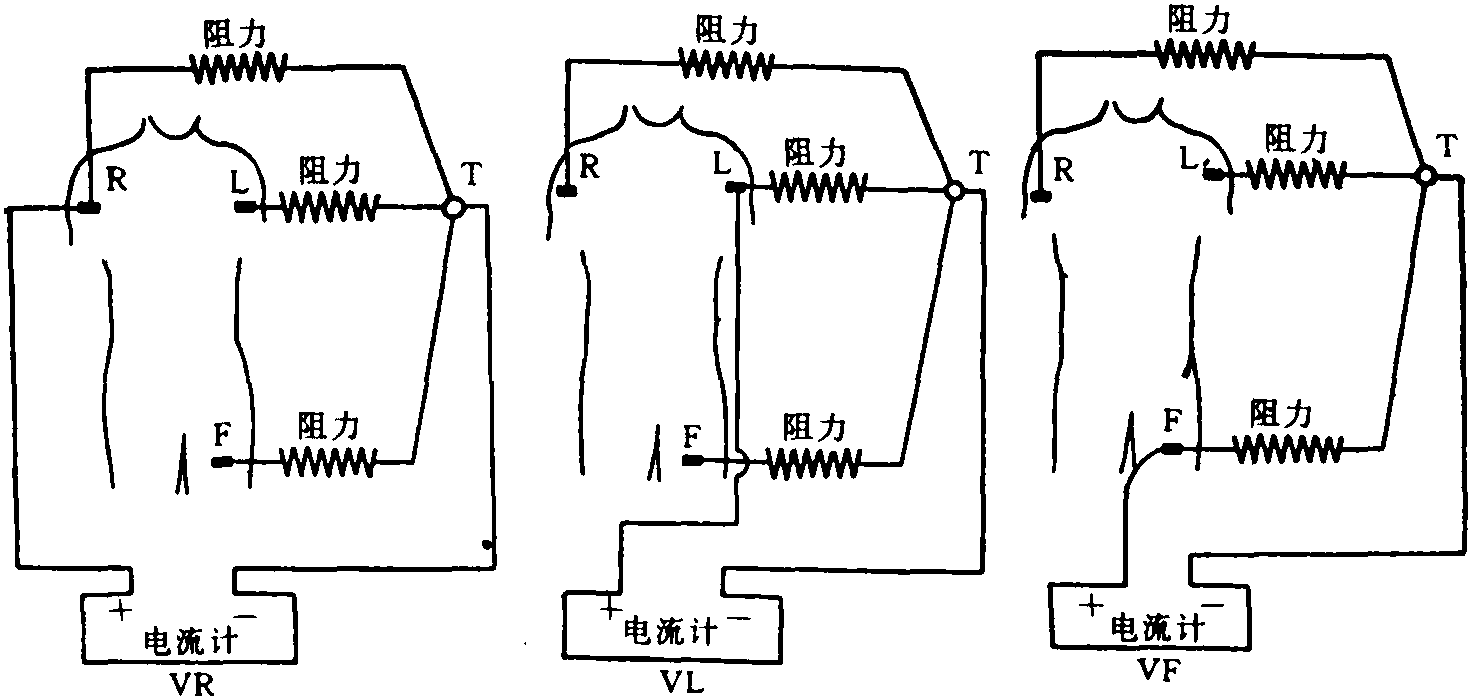 加压单极肢体导联